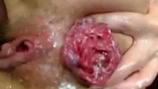 Podwójny fisting dupy i pizdy dla młodej lesbijki